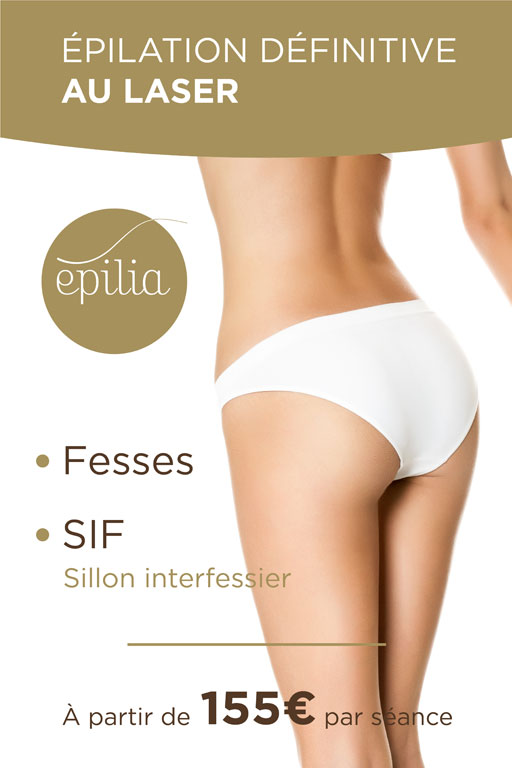epilation-laser-fesses-sif-bruxelles-mob