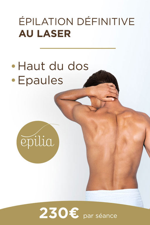 epilation-laser-haut-dos-epaules-bruxelles-mob