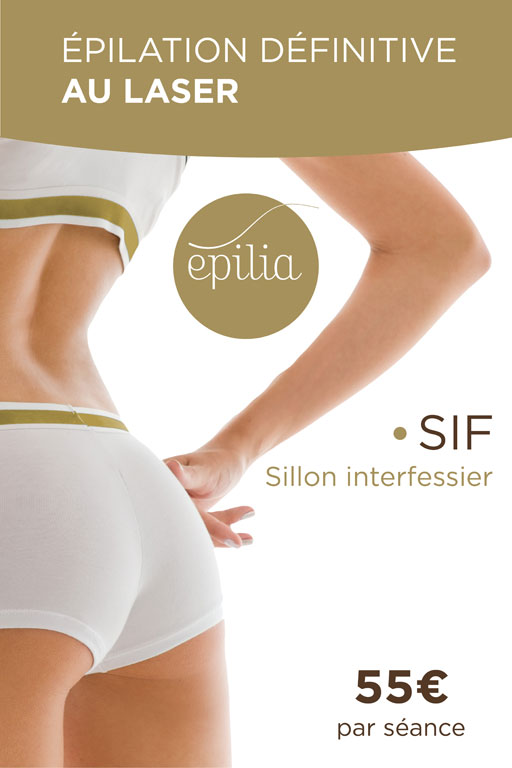 epilation-laser-sif-bruxelles-mob