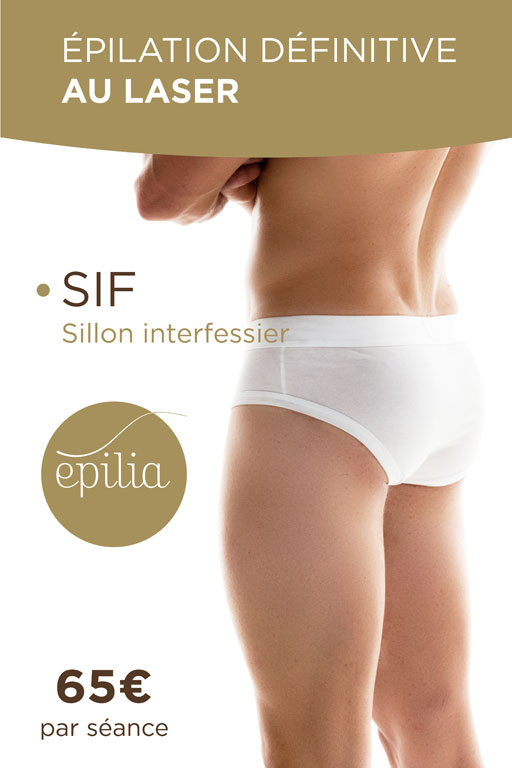 epilation-laser-sif-homme-bruxelles-mob