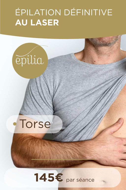 epilation-laser-torse-bruxelles-mob