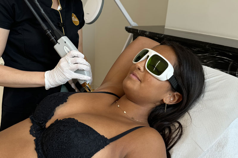 epilation laser peau foncee epilia ixelles louise